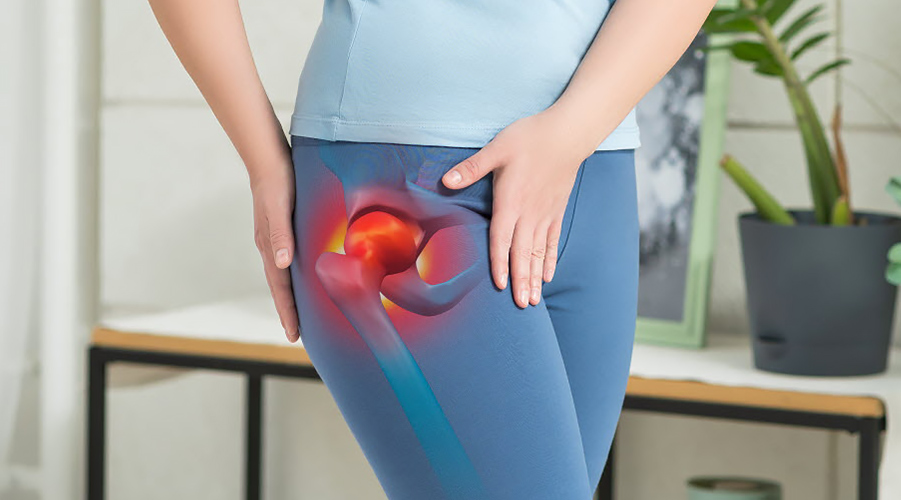 Kalça Kireçlenmesi