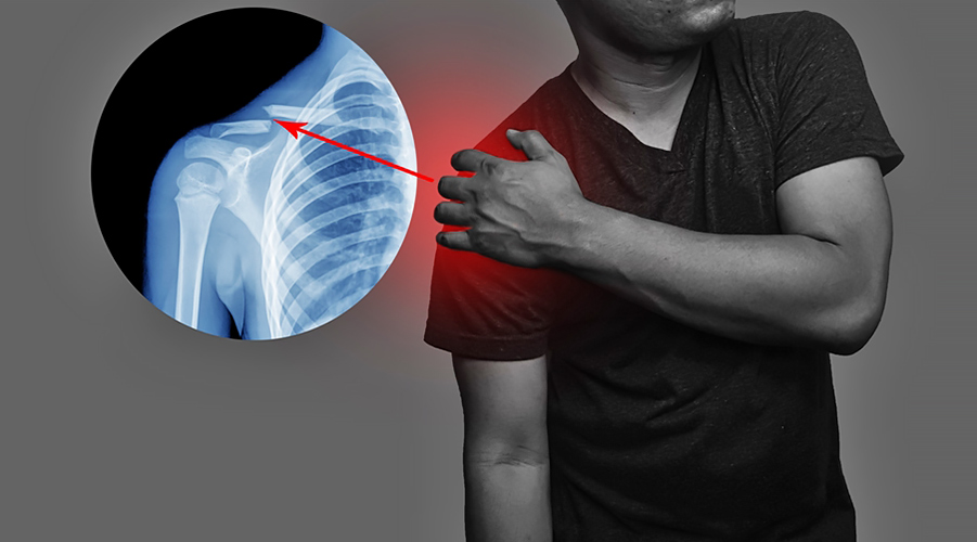 Kırık ve Çıkık Tedavi