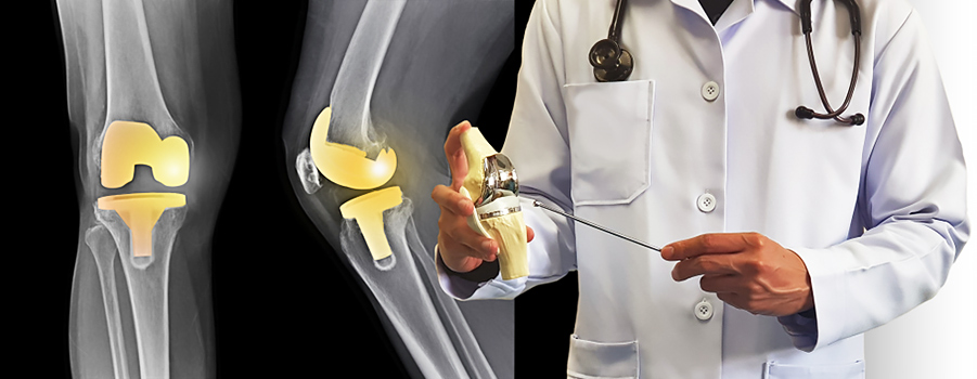 diz protezi sık sorulan sorular