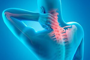 Грыжа шейного диска 