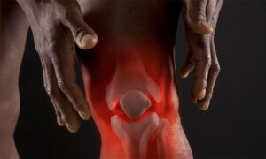 Knee Dislocation Surgery