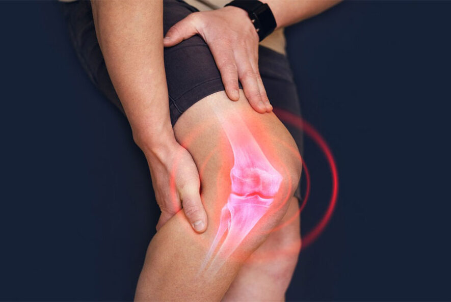 Knee Dislocation Surgery