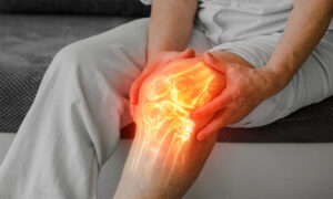 Хирургия артрита коленного сустава