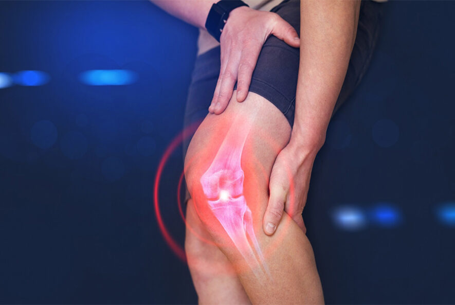 What is an Anterior Cruciate Ligament Injury?