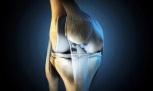 Meniskusriss Symptome