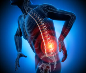 Сдвиг позвоночника