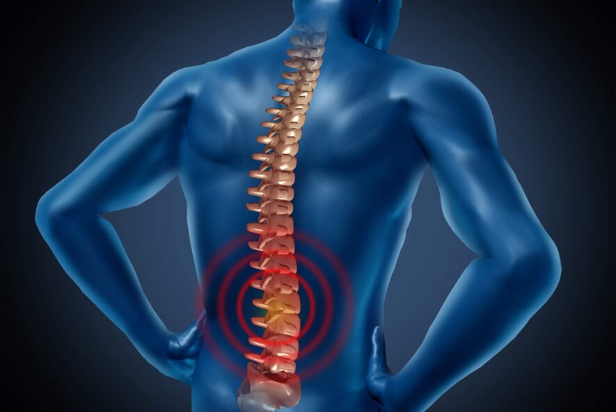 Сдвиг позвоночника