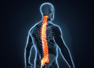 What is a Spinal Tumor?
