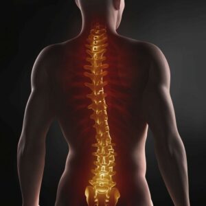 What is a Spinal Tumor?