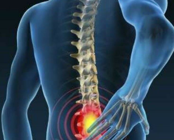 Что такое опухоль позвоночника?
