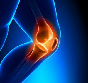 Anterior Cruciate Ligament Tear Symptoms, Causes and Treatment Methods 
