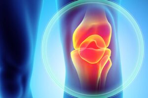 Anterior Cruciate Ligament Tear Symptoms and Treatment Options