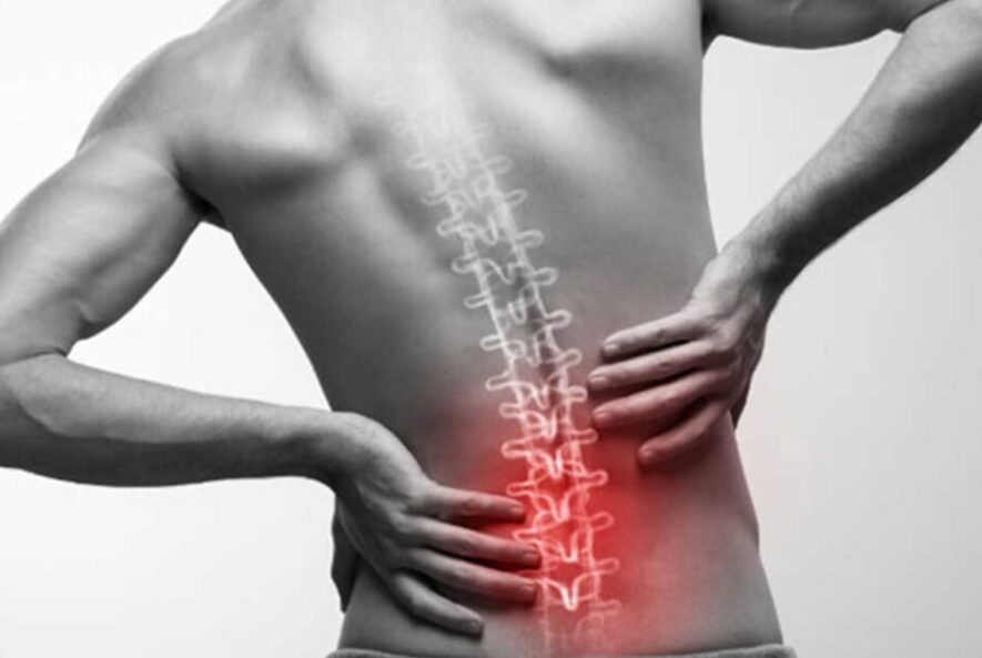 Lumbar Disc Herniation