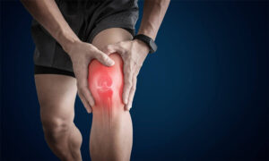 Knee Arthritis Surgery
