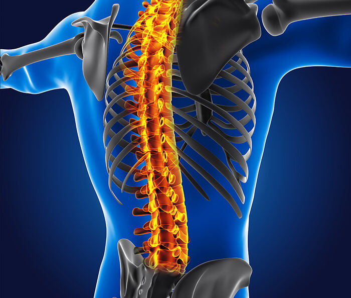 Перелом позвоночника