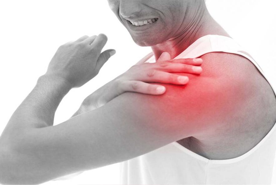 Лечение синдрома импинджмента плеча