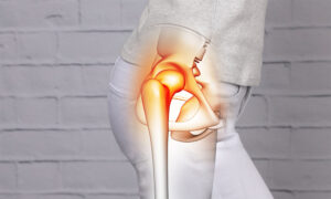 Hip Dislocation Treatment