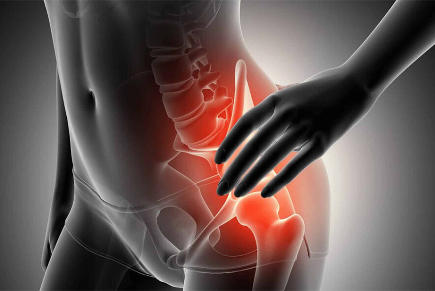 Hip Dislocation Treatment