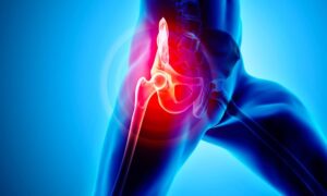 Hüftersatzoperation