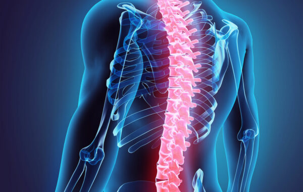 Omurga Kireçlenmesi