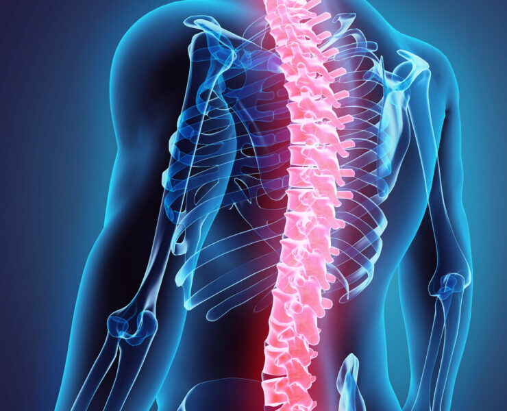 Omurga Kireçlenmesi